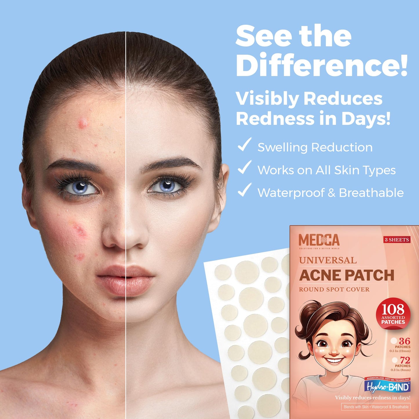 Acne Patches for Face - Hydrocolloid Bandages (108 Count) Pimple Patches for Face in 2 Universal Sizes, Acne Spot Treatment Care for Face & Skin Spot Patch Conceals Zits, Acne and Blackheads