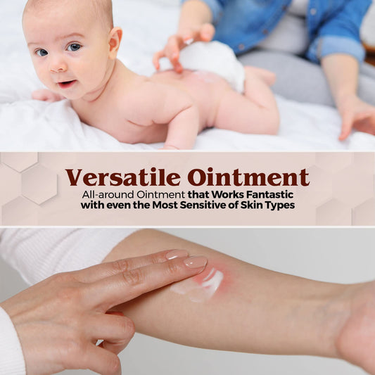 MEDca Vitamin A & D Diaper Rash Ointment- Protectant Cream For Sensitive Baby Skin - Lanolin & Petrolatum Formula, Dry-Cracked Hands/Feet/Face Skin, 1oz Tube, Bulk Case of 72