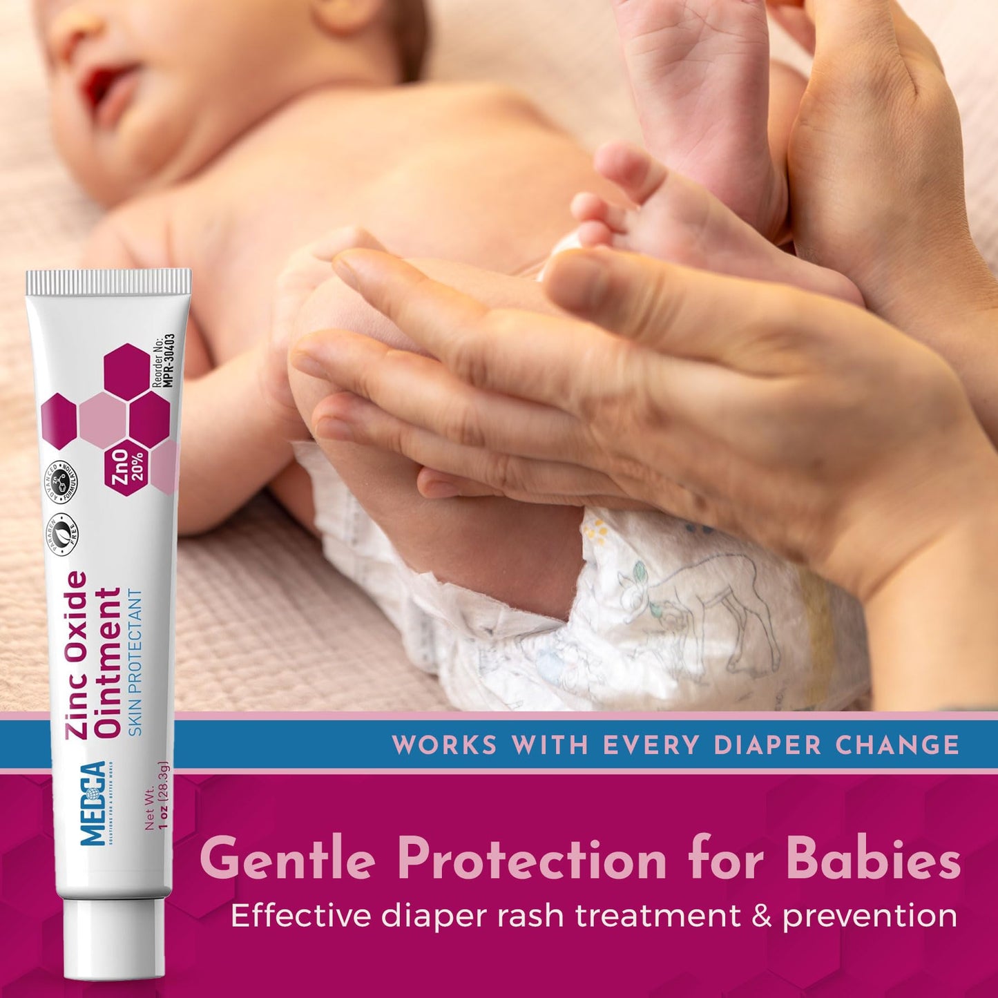 High-Potency 20% Zinc Oxide Ointment - (Pack of 4) Baby Diaper Rash Cream and Gentle Skin Protectant Barrier for Chafed Skin, Wetness, Daily & Overnight Protection Soothing, Hypoallergenic, 1oz Tubes