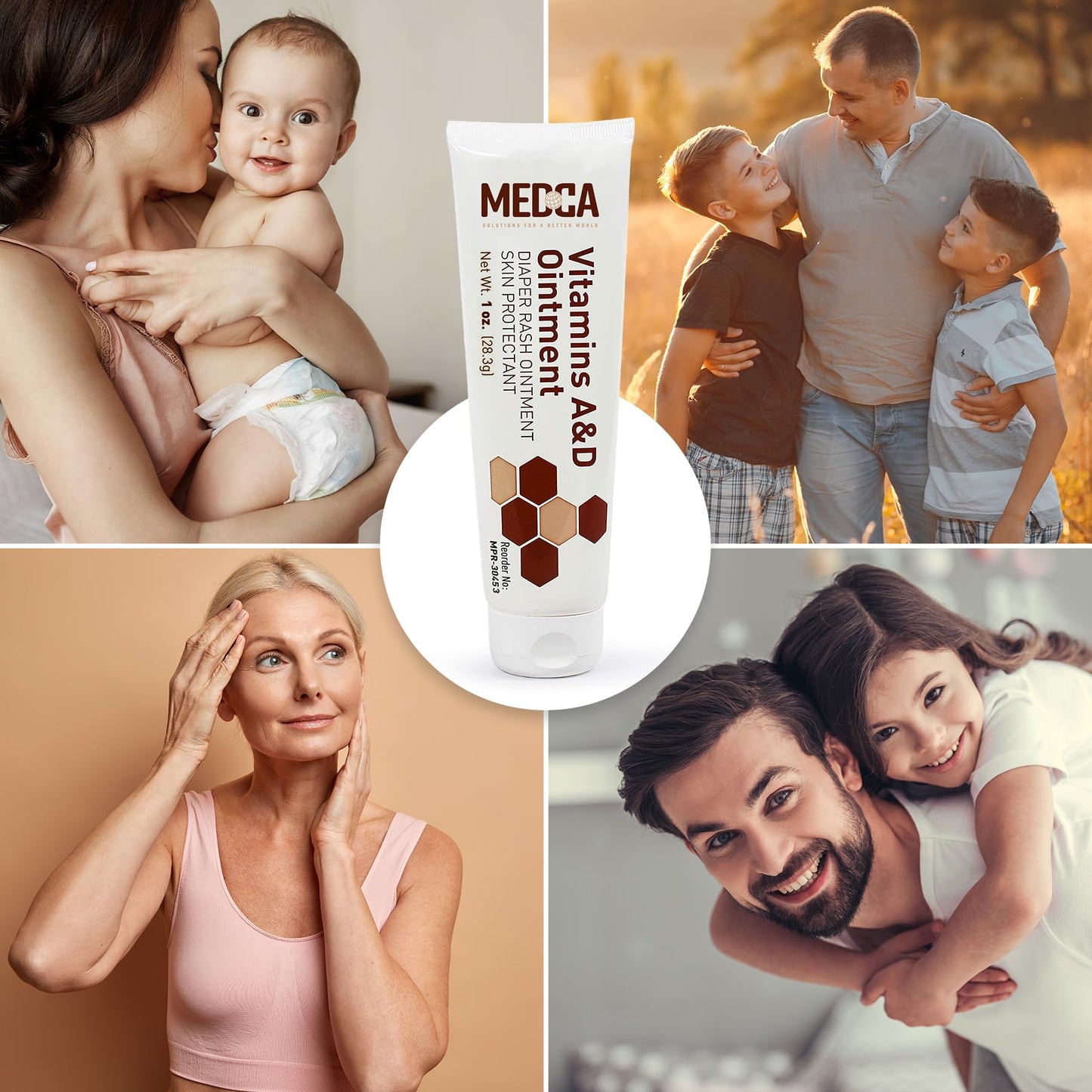MEDca Vitamin A & D Diaper Rash Ointment- Protectant Cream for Sensitive Baby Skin - Lanolin & Petrolatum Formula, Dry-Cracked Hands/Feet/Face Skin, 1oz Tube, Pack of 6
