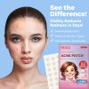 MEDca Universal Acne Absorbing Patch